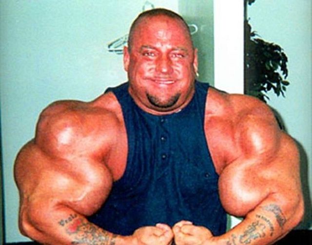 Another Synthol Victim