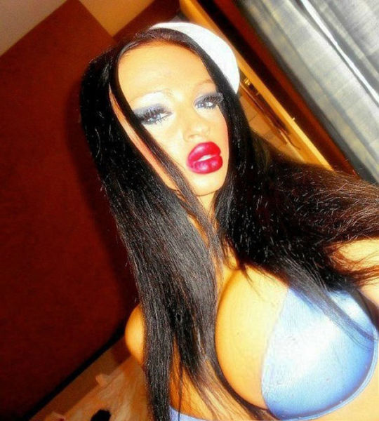 Ladies With Silicone Overdose