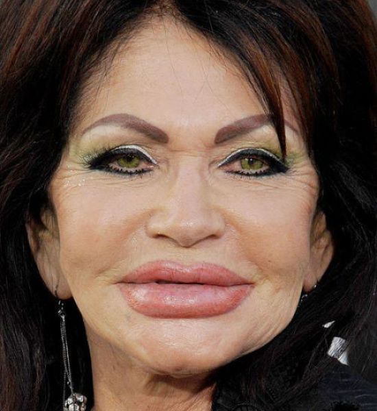 The Horrors of Terrible Plastic Surgery