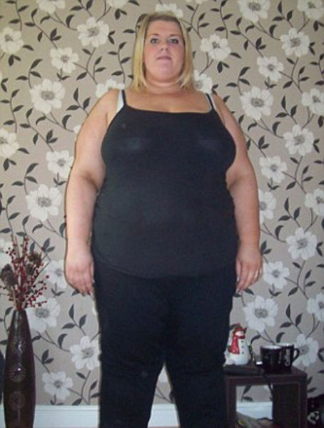 The Secret Shame Behind This Woman’s Amazing Transformation
