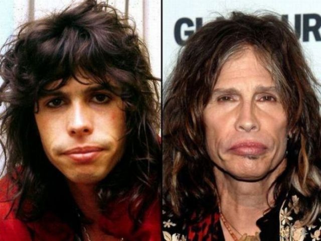 A Few Aging Rock Stars 20 Pics Izismile