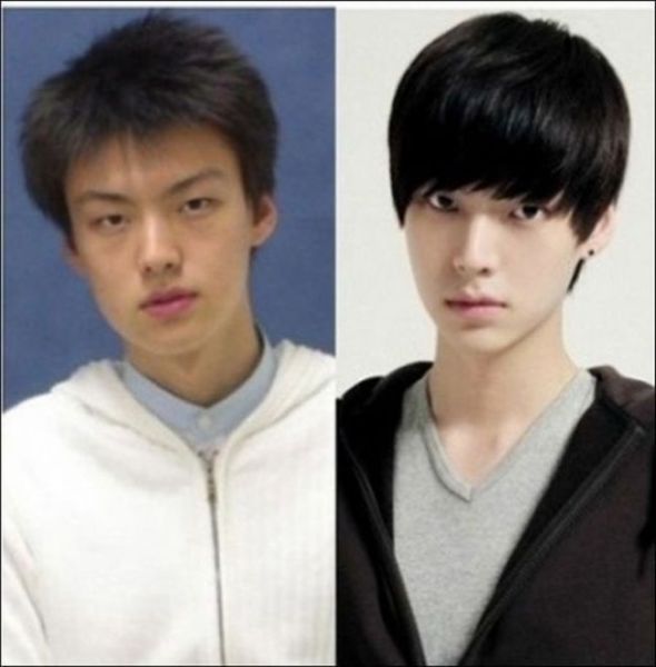 Before and After Photos of Korean Plastic Surgery (30 pics)