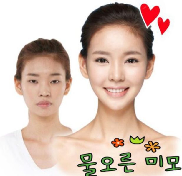 before_and_after_photos_of_korean_plastic_surgery_640_16.jpg