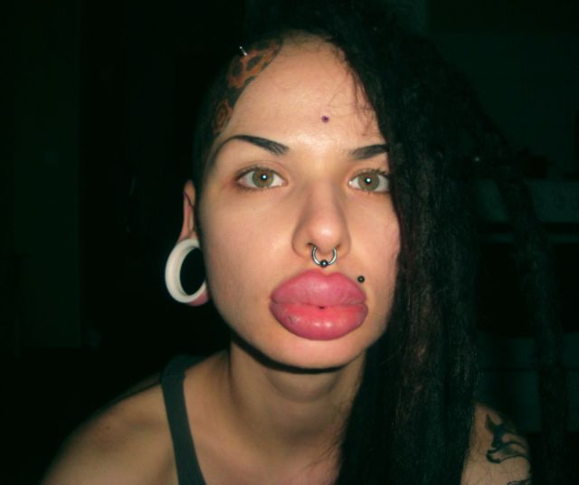 New Photos of the Girl with the World’s Largest Lips