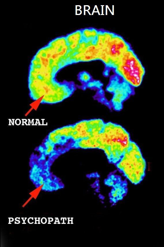 The Psychopath Inside: A Neuroscientist's Personal Journey Into the Dark Side of the Brain