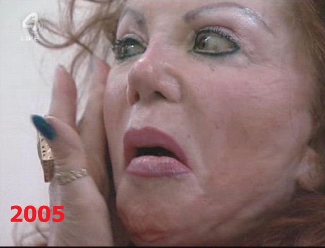 Jackie Stallone Is a Plastic Surgery Addict