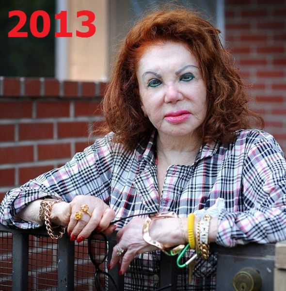 Jackie Stallone Is a Plastic Surgery Addict