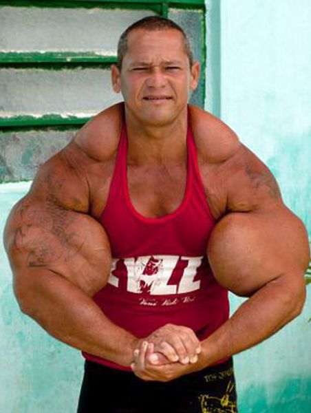 the_man_whose_monster_arms_might_actuall