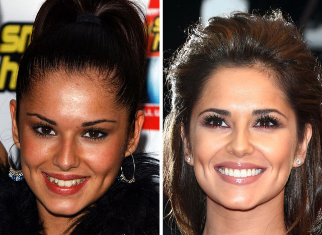 Proof That Teeth Can Completely Change the Way You Look