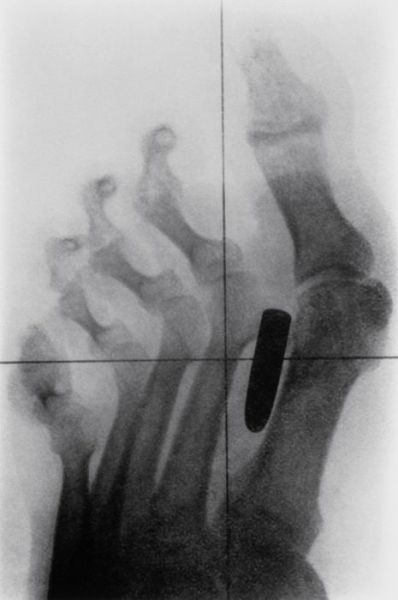 Real X-Rays That Are Will Shock You