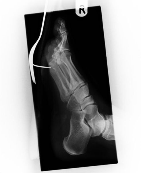 Real X-Rays That Are Will Shock You