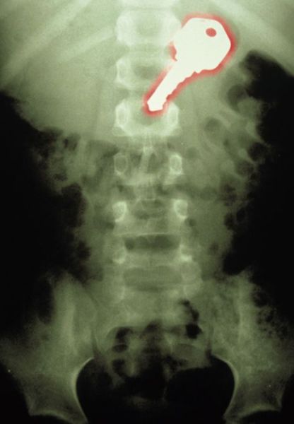 Real X-Rays That Are Will Shock You