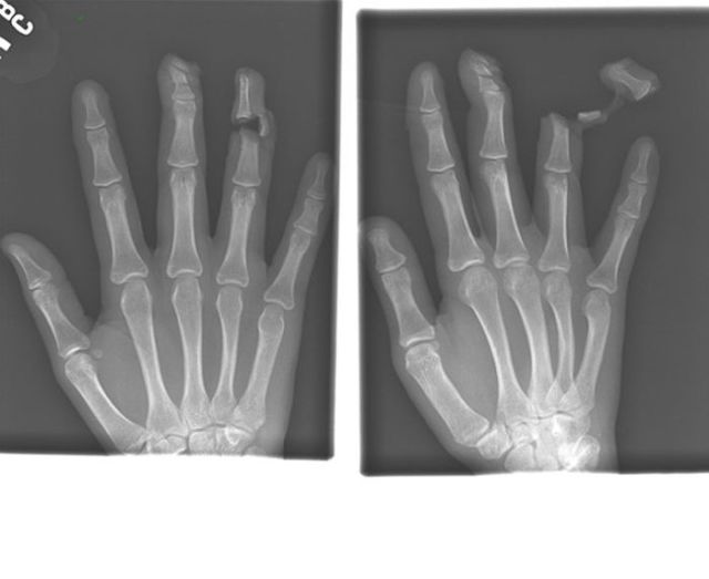 Real X-Rays That Are Will Shock You