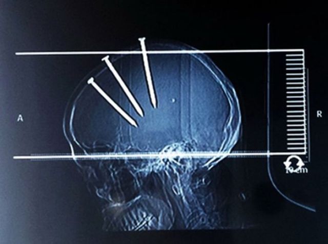 Real X-Rays That Are Will Shock You