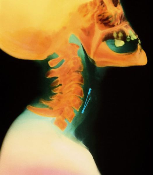 Real X-Rays That Are Will Shock You