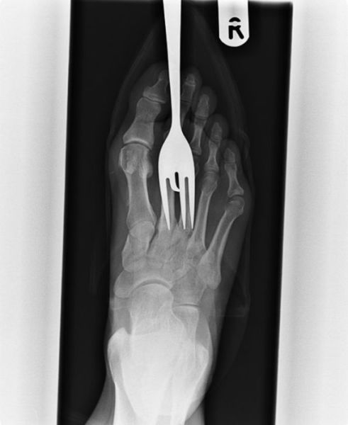 Real X-Rays That Are Will Shock You