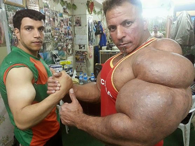 This Guy Has the Most Gigantic Arm Muscles Ever