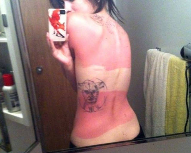Examples When People Forgot They Can Actually Get Sunburns If They Don Examples When People Forgot They Can Actually Get Sunburns If They Don