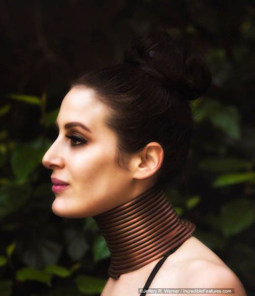 She Literally Stopped Sticking Her Neck Out. The Neck-Rings Of Giraffe