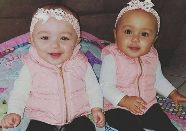 These Awesome Little Twin Sisters Have Defied All The Laws Of Nature