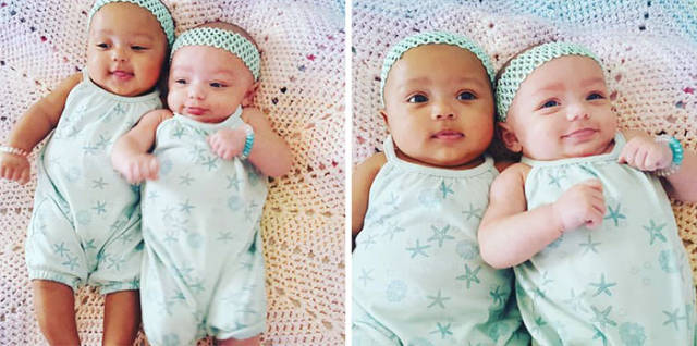 These Awesome Little Twin Sisters Have Defied All The Laws Of Nature