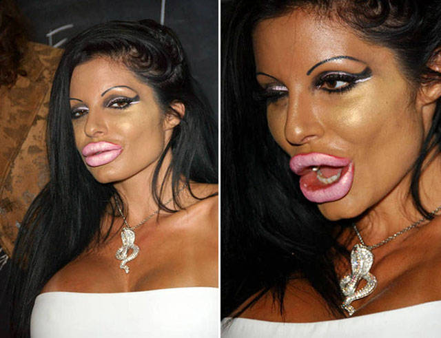 When The Plastic Surgery Fails Irreversibly