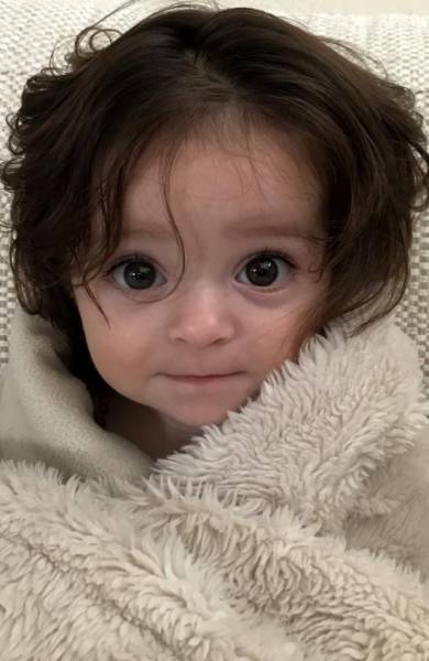This Baby Was Born With A Most Mysterious Trait Imaginable