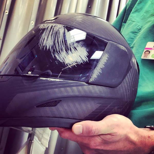 And This Is Why It’s Always A Good Idea To Wear A Helmet!