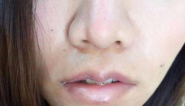 Thai Girls Are Massively Joining The Trend Of Making Their Lips Look Like Turtle Beaks