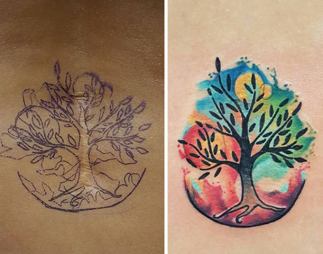 Turns Out, Scars Can Be Perfect Canvas For Tattoos!