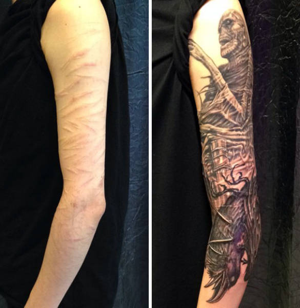 Turns Out, Scars Can Be Perfect Canvas For Tattoos!