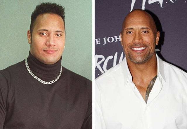 These Celebs Were Not Born Bald, You Know