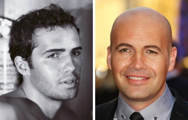 These Celebs Were Not Born Bald, You Know