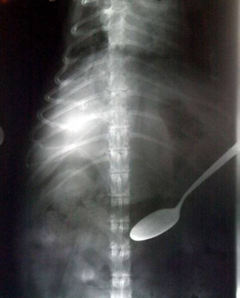 Sometimes, X-Rays Show What You Don’t Want To See