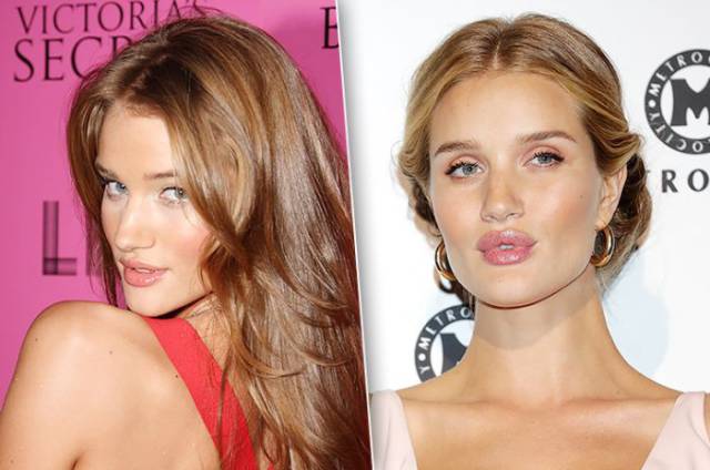 These Celebs Increased Their Lips – But Should They Have Done It?