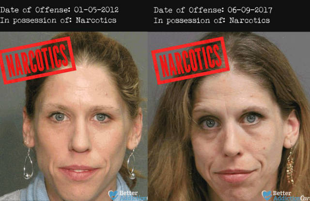 These Horrifying Mugshots Show The Real Effect Of Hard Drugs On Human Body