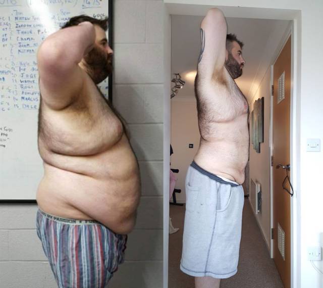 Breakup Became An Ultimate Source Of Inspiration To Lose Weight For This Guy