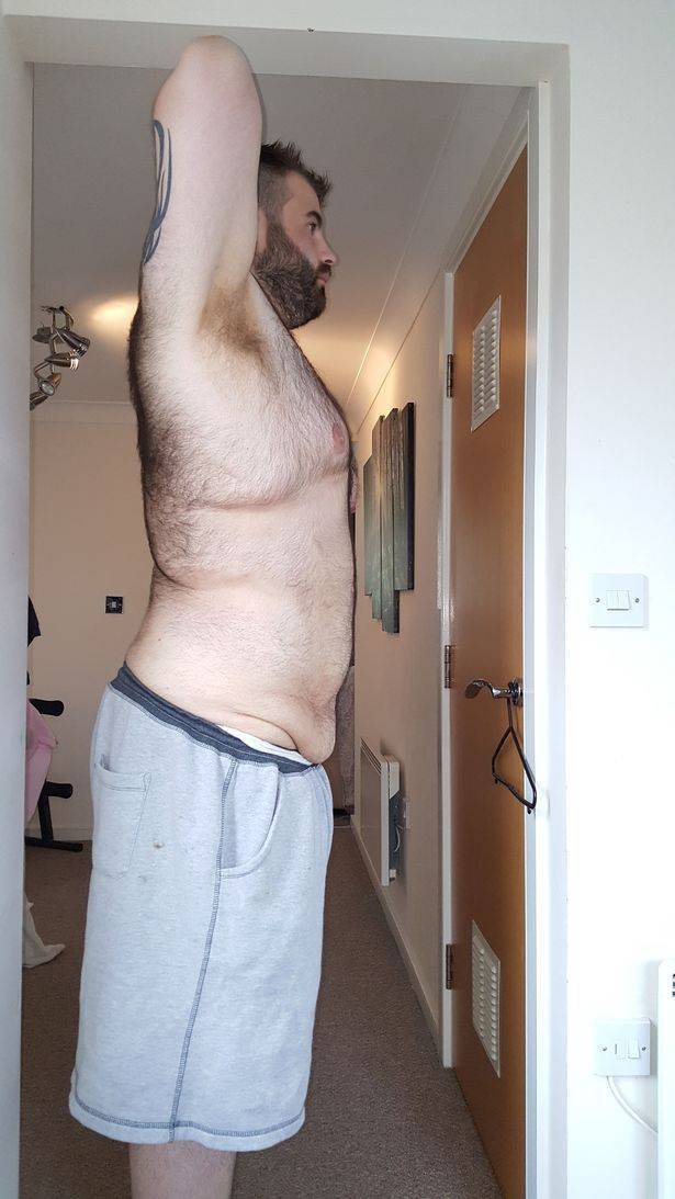 Breakup Became An Ultimate Source Of Inspiration To Lose Weight For This Guy