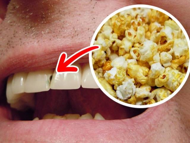 You’d Better Avoid These Foods To Keep Your Smile Fresh And Healthy