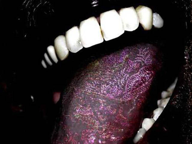 Fashion Takes A New Turn With Tongue Tattoos