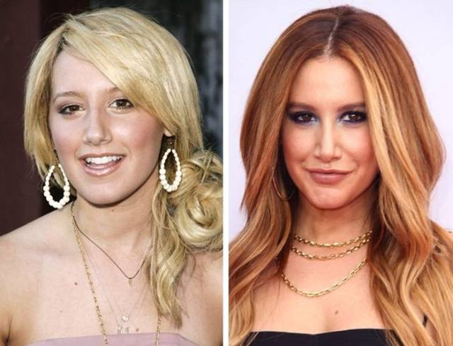 How Plastic Surgeries Have Influenced Some Celebrities