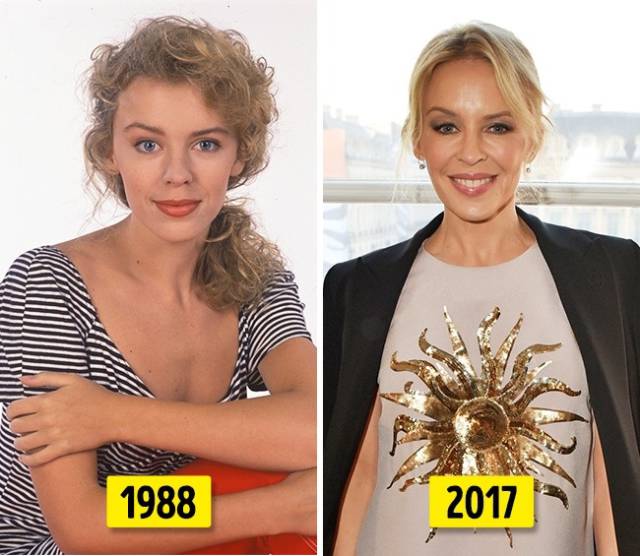 Some Celebs Have Changed Beyond Recognition