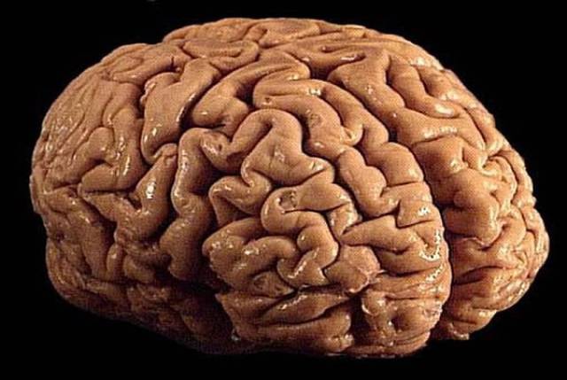 Human Brain Is Too Wonderful To Understand It