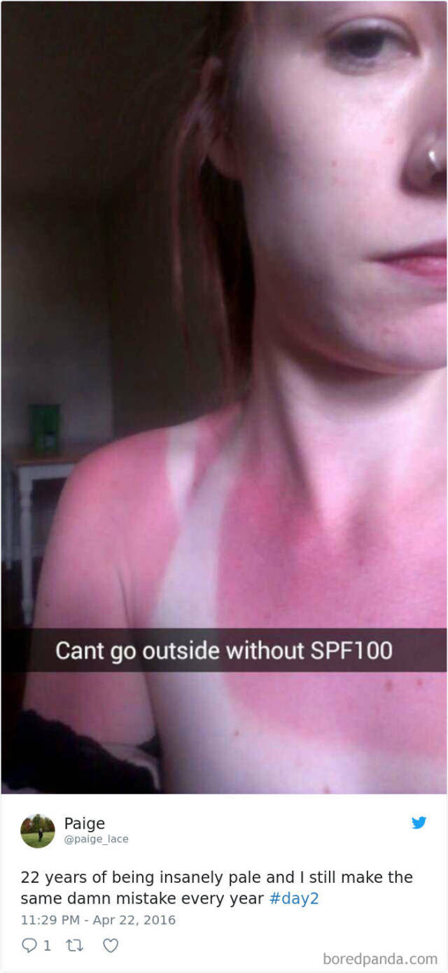 Being Pale Brings Quite A Bit Of Problems Along