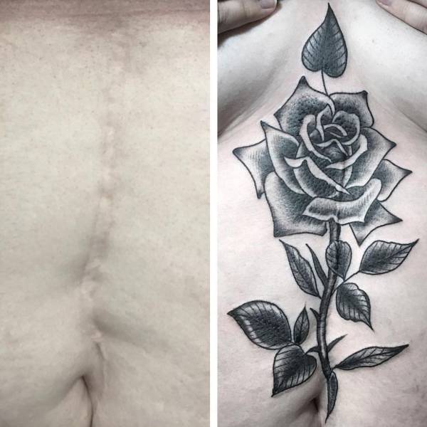 Awful Scars Can Be Covered With Beautiful Tattoos
