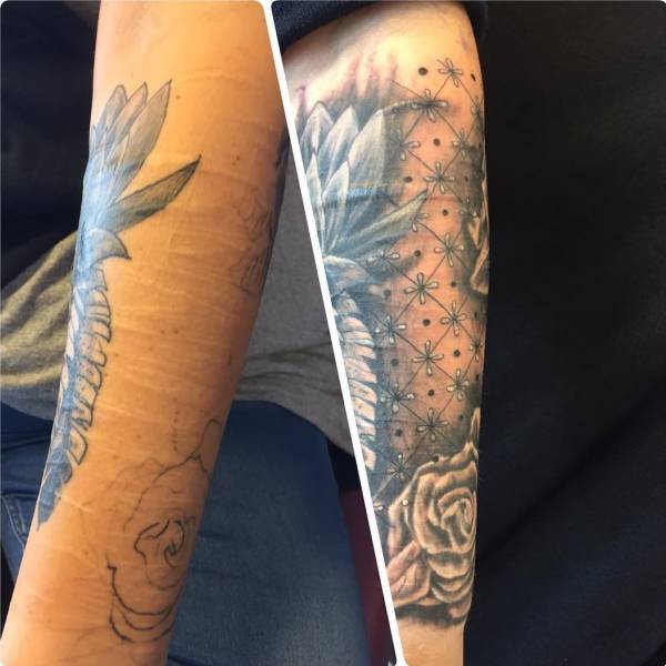 Awful Scars Can Be Covered With Beautiful Tattoos