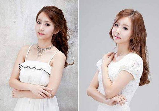 Surgery Turned These Twins From Ugly Ducklings Into Hot Beauties