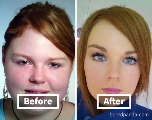 here-s-how-weight-loss-can-change-your-face-40-pics-izismile