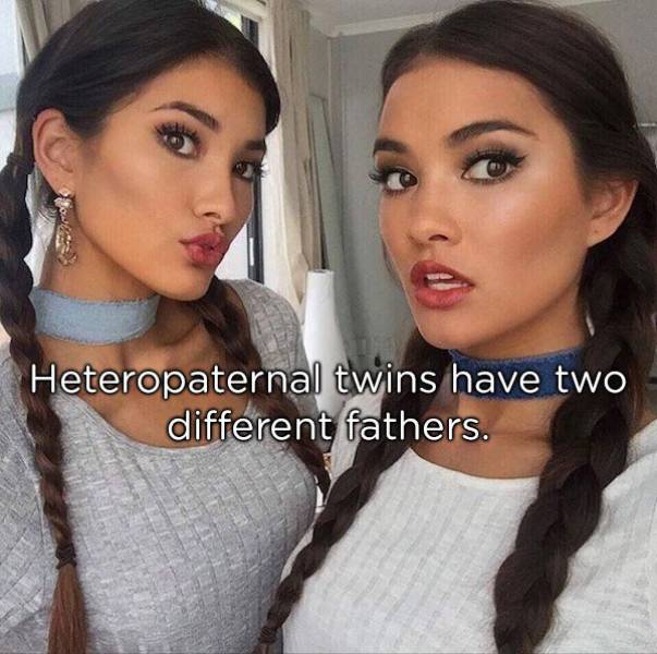 Identical Facts About Twins (18 pics)