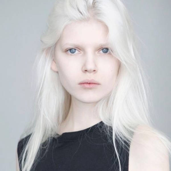 How Albinos From Various Races Look Like (22 pics) - Izismile.com